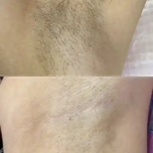 Birgül Güzellik Salonu