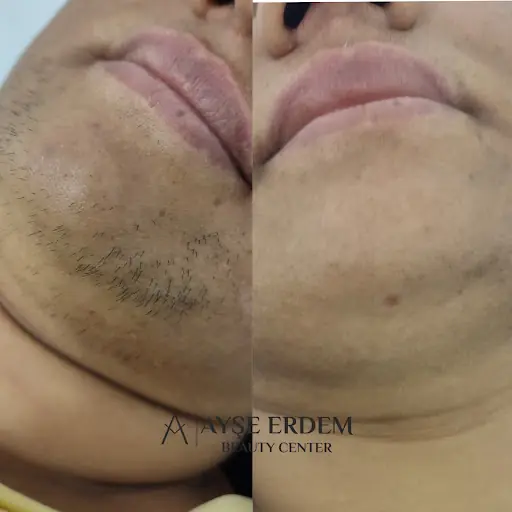 Ayşe Erdem Beauty Center 4