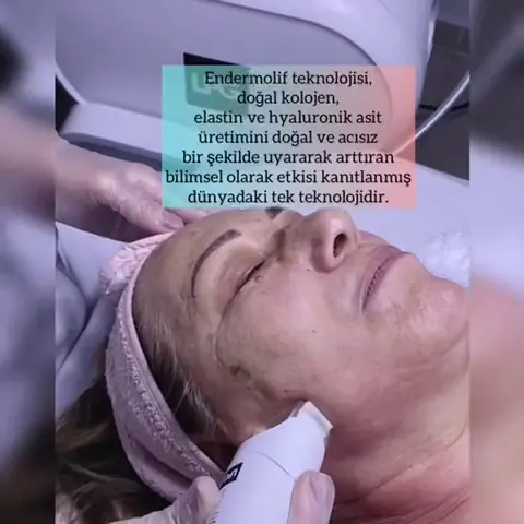 Yıldızlı güzellik 4