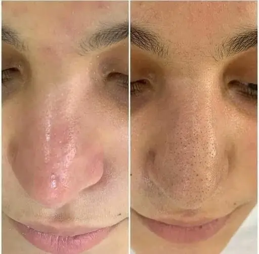 ESKİŞEHİR DE BEAUTY CENTER