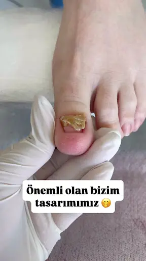 Bubu tırnak ve guzellik 3