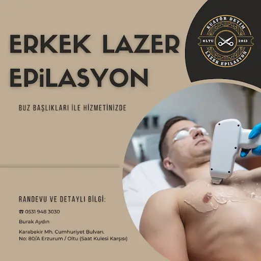 Oltu Erkek Lazer Epilasyon. KUAFÖR DEYİM 4