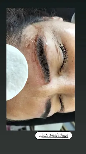 Nergiz Özkan Güzellik & Zayıflama 3