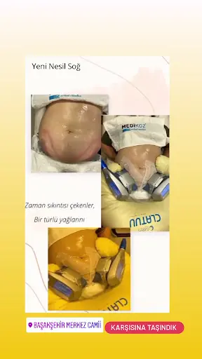 Başakşehir Estetik ve Güzellik Merkezi 2