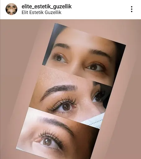 Elit Estetik Güzellik 4