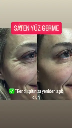 SD GÜZELLİK DÖŞEMEALTI