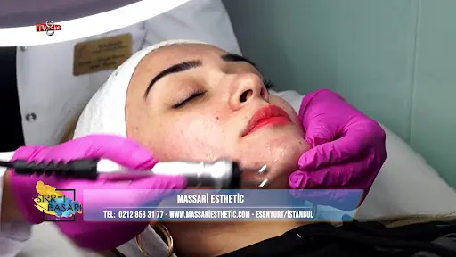 Massari Esthetic Güzellik Salonu | Protez Tırnak | İpek Kirpik | Hydrafacial Cilt Bakımı | Lazer Epilasyon | 3