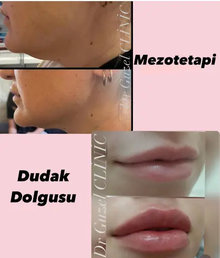 Dr Güzel Clinic 4
