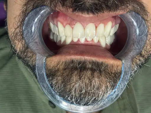 İvrindi Diş Kliniği 2