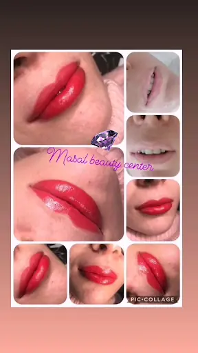 Masal Beauty Center Güzellik Merkezi 3