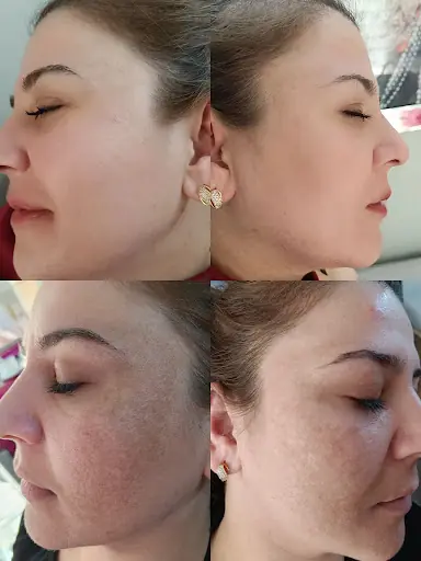 HüLYA GÜZELLİK VE KUAFÖR SALONU MALATYA 2