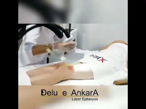 Deluxe Ankara Lazer Epilasyon Merkezi 3