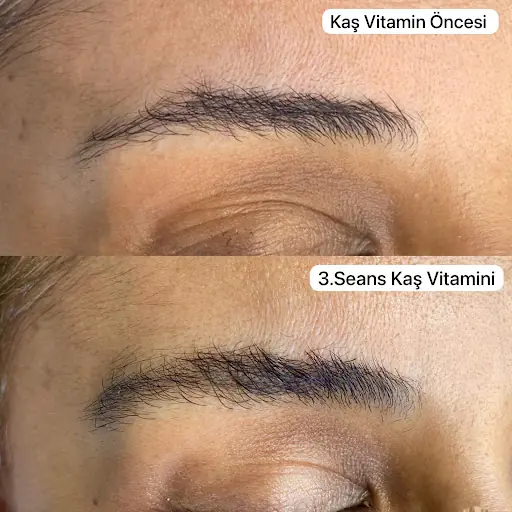 Merve Çırpan Beauty 3