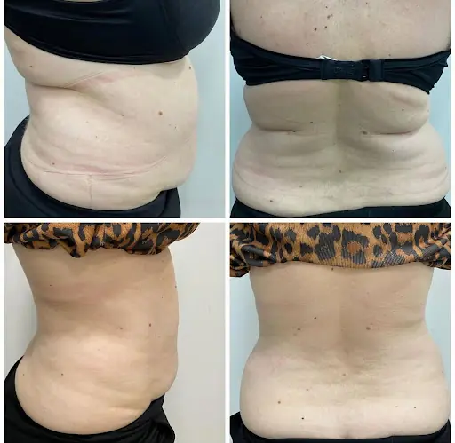Dermavise Isparta 4