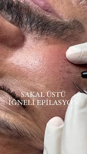 epimedbeauty 3