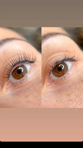 Diamond estetik güzellik