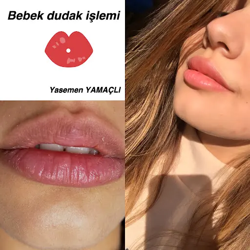 YASEMEN YAMAÇLI GÜZELLİK 2