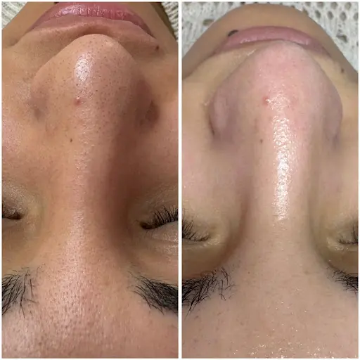ÖZLEM BEAUTY CENTER AKSARAY