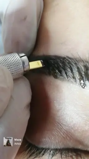 Düziçi Duru Lazer Epilasyon Merkezi 3