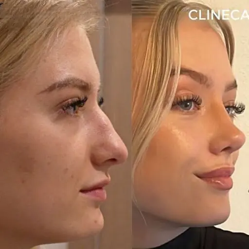 Pera Paris VIP Güzellik 2