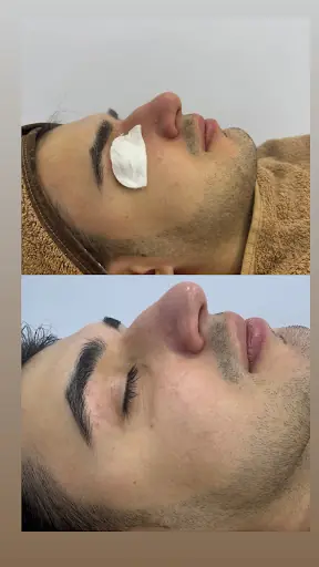Alebra Beauty - Lazer Epilasyon, Cilt Bakımı, Kirpik Lifting, Kalıcı Makyaj, Manikür Pedikür 2