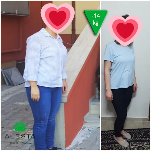 ALESTA Güzellik & Zayıflama 2