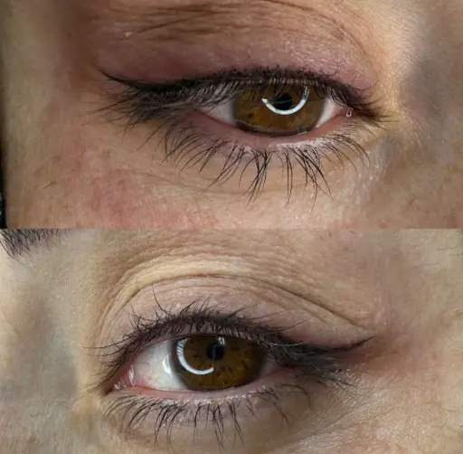 Aynur Medical Estetik ve Güzellik Merkezi – Tırnak / Nail Studio, İstanbul