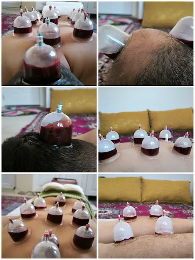 Dargeçit Hacamat ve Sülük Merkezi 3