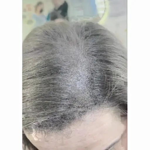 Saç Simülasyonu ve Microblading İstanbul - Bien Beauty Studio 2