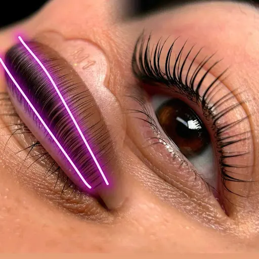Tual Estetic Pendik Lazer Epilasyon / iğneli epilasyon / needle epilation / игольная эпиляция / Kirpik Lifting / Cilt bakım 4