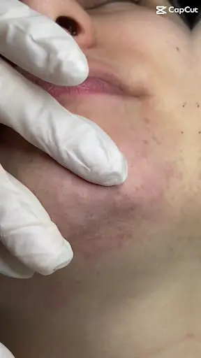 Ülkü Keleş | Microblading | Kaş Tasarımı | İğneli Epilasyon | Kaş Laminasyonu | Kalıcı Makyaj | Cilt Bakımı | Kirpik Lifting 3