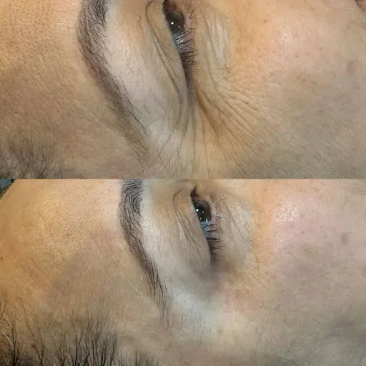 ELMİRA BEAUTY – Lazer Epilasyon, İstanbul (2. fotoğraf)
