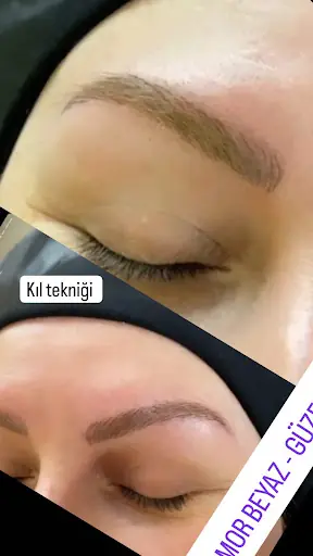 MOR BEYAZ Güzellik Salonu Epilesyon , Cilt Bakımı 2