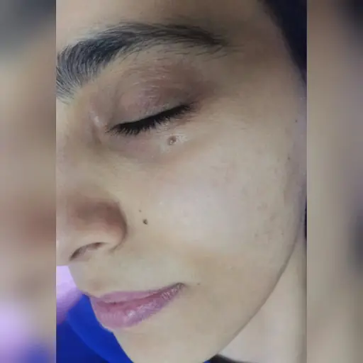 SEMAY ÖZCAN GÜZELLİK VE ESTETİK MERKEZİ 3
