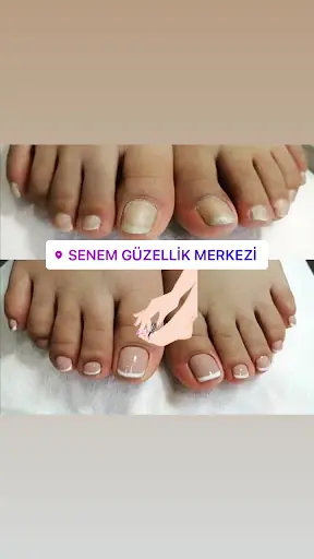 Senem Güzellik Merkezi 3