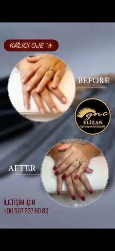 Elizan Güzellik ve Lazer Epilasyon Merkezi