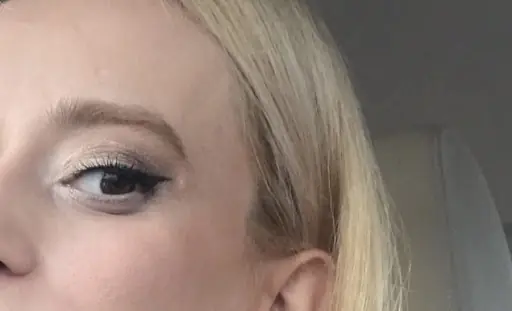 Mila Estetik 4