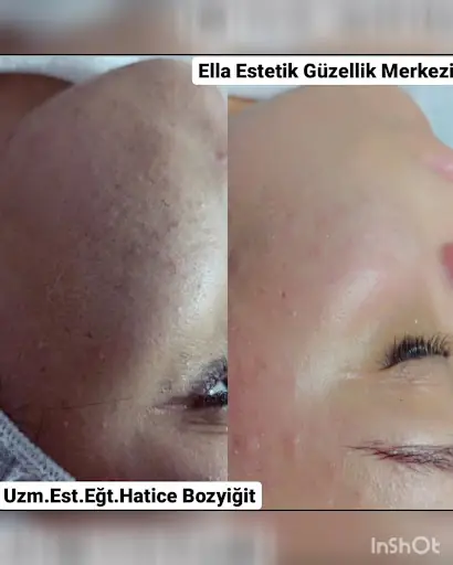 Şereflikoçhisar Ella Estetik ve Güzellik Merkezi 3