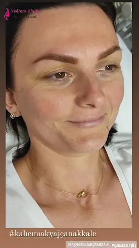 Fehime DALGIÇ Güzellik Estetik 2