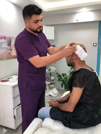 Erzurum Saç Ekim Merkezi Saç PRP`si | Altınsoy Hair Clinic 4