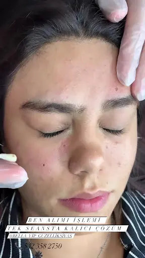 Bella Güzellik Merkezi 2