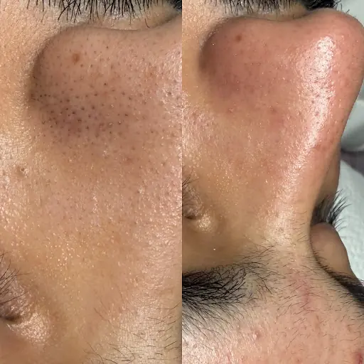 Beauty Care island İstanbul - Şişli Güzellik Merkezi - Bomonti Cilt Bakımı - Manikür Pedikür - G5 - G8 - Wax - Ağda 3