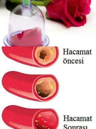 Kulu Hacamat