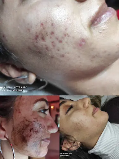 Essvia Güzellik ve Estetik 3