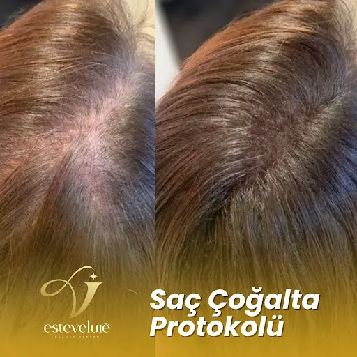 Estevelure Tuzla Beauty Center 3
