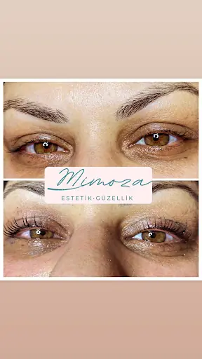 Isparta/Mimoza Estetik ve Güzellik Merkezi 3