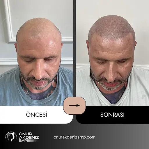 Onur Akdeniz SMP – Diğer (Güzellik), İstanbul