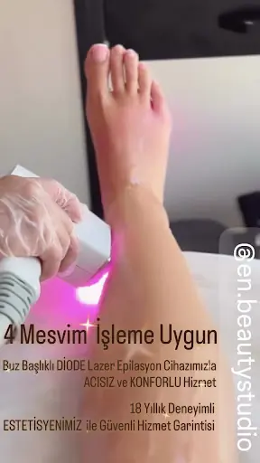 EN.BEAUTY STUDIO | Lazer Epilasyon | Protez Tırnak | Güzellik Merkezi 3