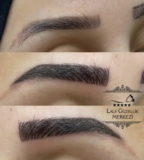 LALE GÜZELLİK SALONU Lazer epilasyon ve cilt bakım hizmetleri