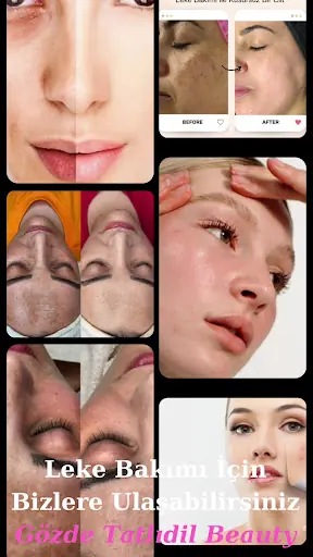 Tu-Ez - Dalaman Güzellik Salonu - Kalıcı Makyaj - Manikür - Pedikür - Lazer Epilasyon - Kirpik Saç Bakımı 5